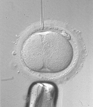 Aumentan los tratamientos de fertilidad con donación de óvulos