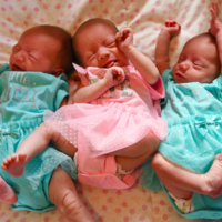 El insólito caso de las trillizas MoMo: compartieron placenta y bolsa, y son idénticas