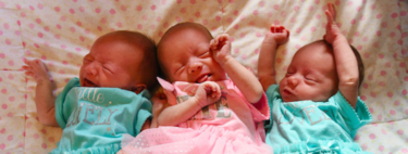 El insólito caso de las trillizas MoMo: compartieron placenta y bolsa, y son idénticas