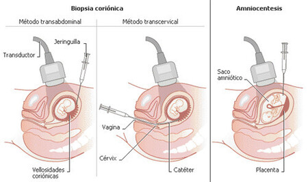 biospia-corion