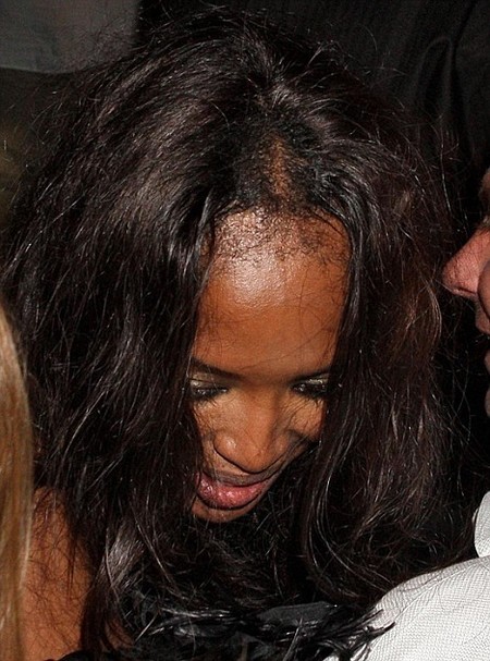 Las celebrities y el cabello. También ellas padecen caída de cabello
