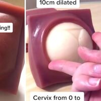 Una matrona enseña en Tik Tok cómo se dilata el cérvix para dar a luz y su vídeo se vuelve viral  