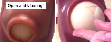 Una matrona enseña en Tik Tok cómo se dilata el cérvix para dar a luz y su vídeo se vuelve viral  