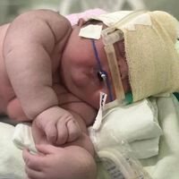 "Lo imaginábamos más pequeño": nace un bebé gigante en Brasil de 7,3 kg y 59 centímetros 