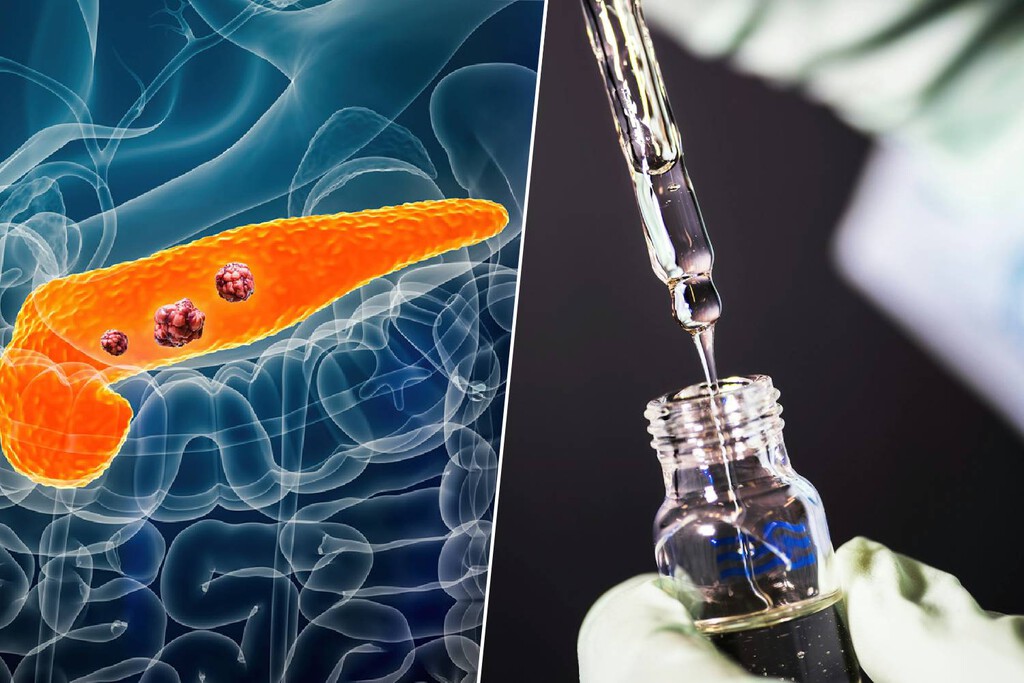El cáncer de páncreas era casi invencible. Una nueva terapia dirigida acaba de duplicar la supervivencia