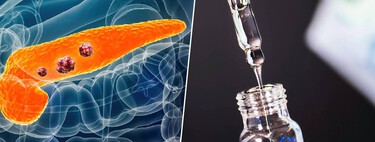 El cáncer de páncreas ha sido siempre uno de los más difíciles de combatir y curar por la medicina. Hasta ahora