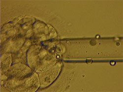 Diagnóstico preimplantatorio contra las enfermedades hereditarias