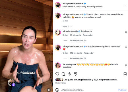 Celulitis Vicky