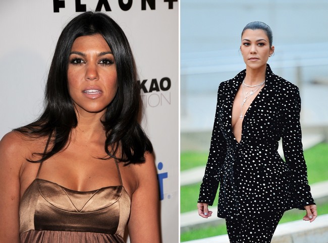 Kardashian Cirugia 06