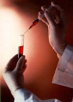 Las vías de doping más conocidas y sus efectos secundarios (III): Hormona de Crecimiento (hGH)