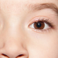 Mi hijo tiene un orzuelo: por qué sale y qué hacer si aparece