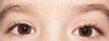 Mi hijo tiene un orzuelo: por qué sale y qué hacer si aparece