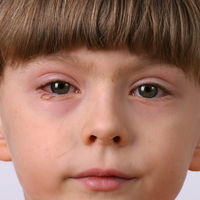 La salud ocular de los niños en tiempos de coronavirus: qué síntomas tener en cuenta y cómo cuidar los ojos de nuestros hijos