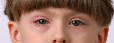 La salud ocular de los niños en tiempos de coronavirus: qué síntomas tener en cuenta y cómo cuidar los ojos de nuestros hijos