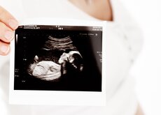 Ecografia 4d Cuando Hacerla