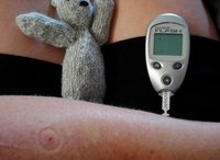 Perros adiestrados para olfatear la diabetes infantil