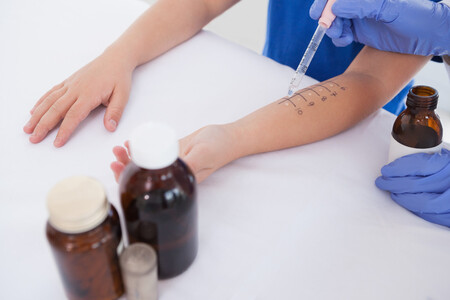 alergia al látex