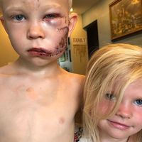 Un niño de seis años salva a su hermana del ataque de un perro y recibe el apoyo de sus héroes favoritos