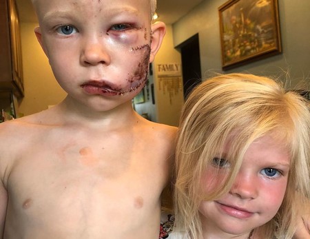 Un niño de seis años salva a su hermana del ataque de un perro y recibe el apoyo de sus héroes favoritos