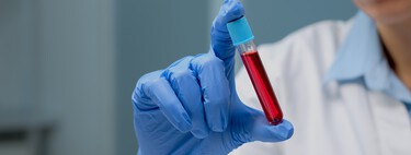 La posibilidad de detectar el alzhéimer con un análisis de sangre es ya una realidad, y es un avance tremendo que ahorrará muchos problemas