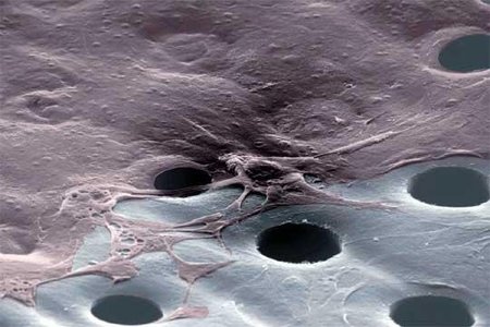 Nanotecnología para combatir el cáncer