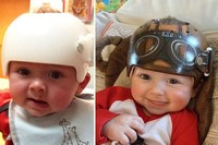 Una artista californiana decora los cascos correctores de los bebes con un increíble resultado