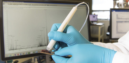 Este dispositivo detecta tejido canceroso en solo diez segundos