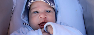 Labio leporino y paladar hendido en el bebé, ¿se puede prevenir?