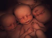 Nacen unos cuatrillizos por embarazo natural en México