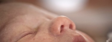 ¿Cuáles son las lesiones más habituales de los bebés durante el parto?