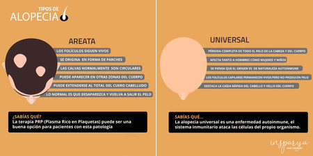 Alopecia Areata Universal