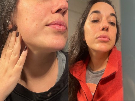 Seis Meses Usando Retinol Efectos Y Aspecto De La Piel 3