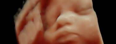 Ecografía 5D en el embarazo: qué es y cuándo hacerla