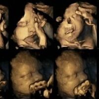 Así reacciona un bebé en el vientre cuando su madre fuma durante el embarazo