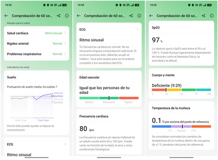 Este es el informe que se genera en solo 60 segundos | Imagen: Xataka