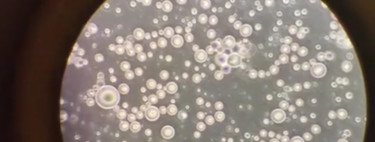 ¿Quieres ver cómo es la leche materna de cerca? La han grabado en vídeo a través del microscopio