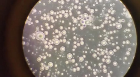 ¿Quieres ver cómo es la leche materna de cerca? La han grabado en vídeo a través del microscopio