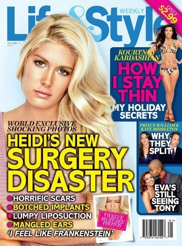 Después de tanta cirugía, Heidi Montag está hecha un auténtico cromo