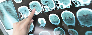 Las cinco mejores formas en las que el ejercicio físico te ayuda a cuidar de tu cerebro 