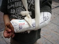 Como declarar los ingresos por IT por parte del autónomo