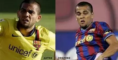 Dani Alves pasa por el quirófano y se opera las orejas