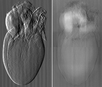 Tomografías capaces de mostrar tejidos y venas de forma nítida