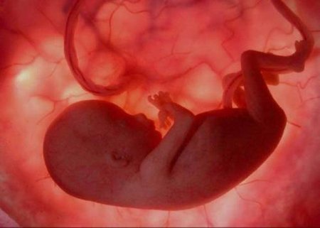 El síndrome de alcoholismo fetal o los efectos del alcohol en el desarrollo cerebral incluso a niveles moderados