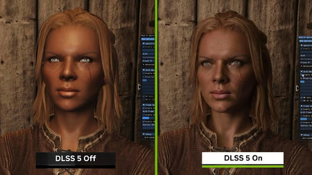 Dlss B