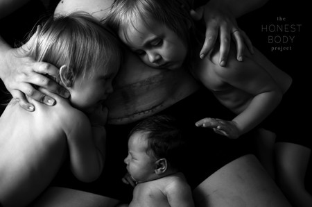 Fotos Cesarea Honest Body 3