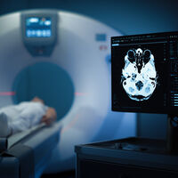 A ciência acaba de chocar o mundo ao descobrir o efeito inesperado de um derrame que apagou para sempre a tristeza do cérebro de um paciente 