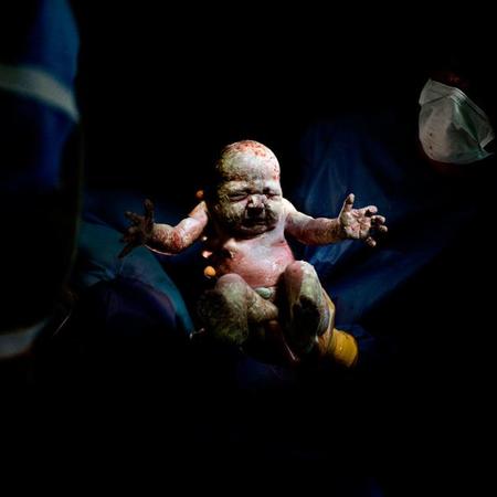 "César", una impactante serie de fotografías de bebés nacidos por cesárea