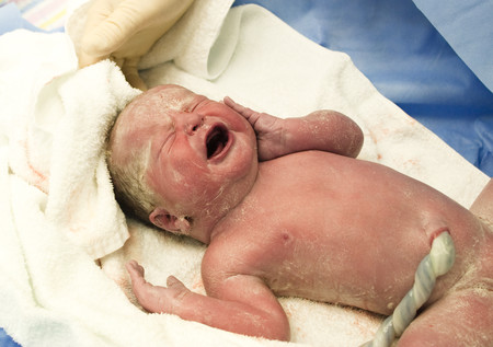 Pinzamiento del cordón umbilical y mortalidad