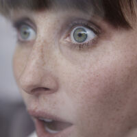 Parece filme de terror: mulher nota nódulo na pálpebra e, 1 mês depois, tem verme de 11cm extraído vivo da região ocular 