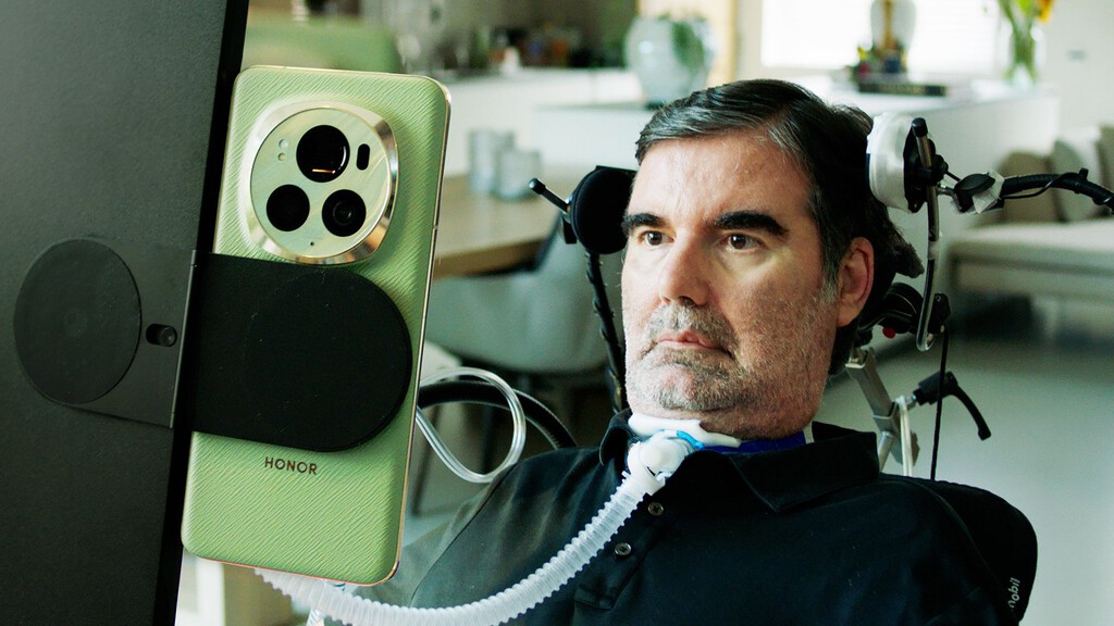 Bernard Muller: un artista de la IA y un ejemplo de resiliencia en la lucha contra la esclerosis lateral amiotrófica 